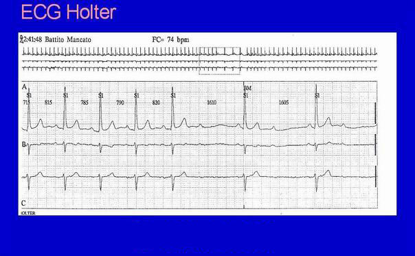 holter grafico